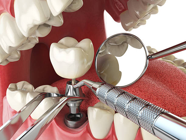 Best Broken or Cracked Tooth Emergency Dentist in Lake Wazeecha, WI