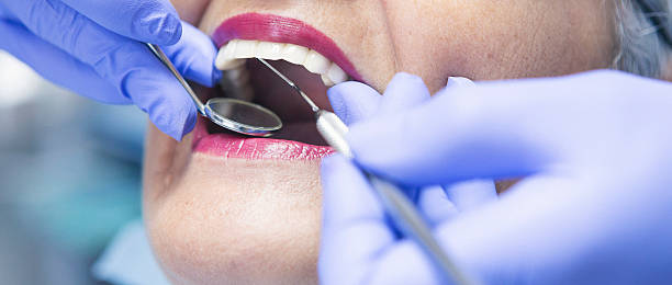 Best Emergency Dentist for Lost Fillings or Crowns in Lake Wazeecha, WI